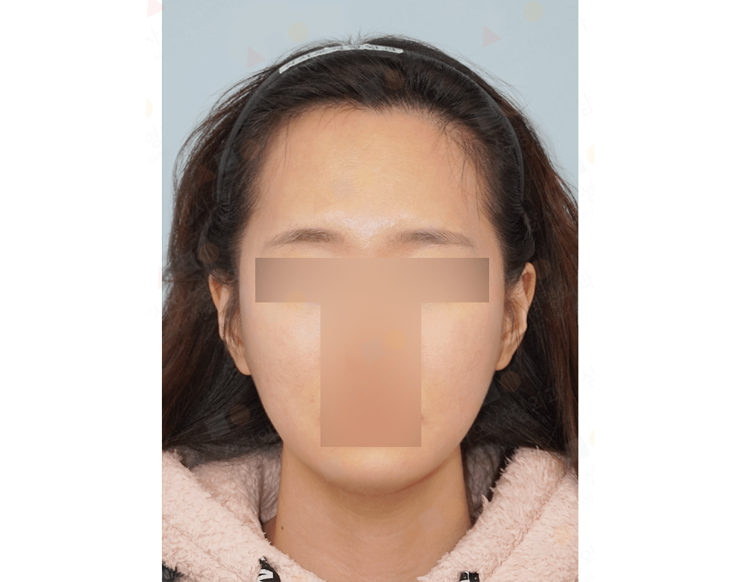 Person with facial features obscured by pixels