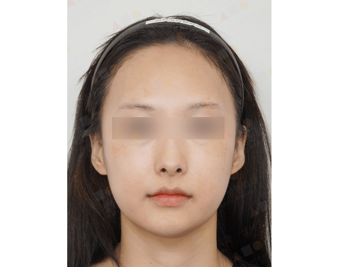 Person with blurred eyes and headband facing camera.