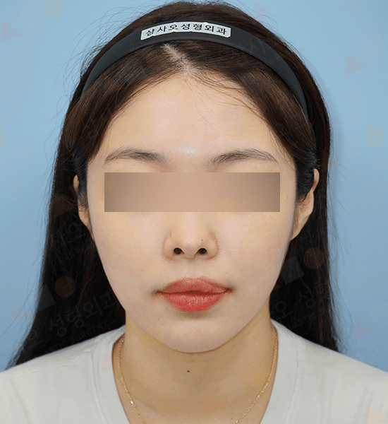 Woman with blurred eyes and headband, frontal view.