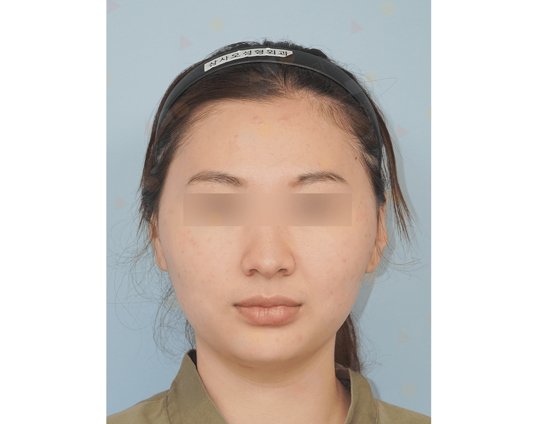 Person with hairband, eyes obscured, neutral expression.