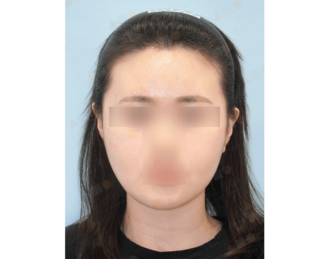 Person with blurred face, headband on light background.