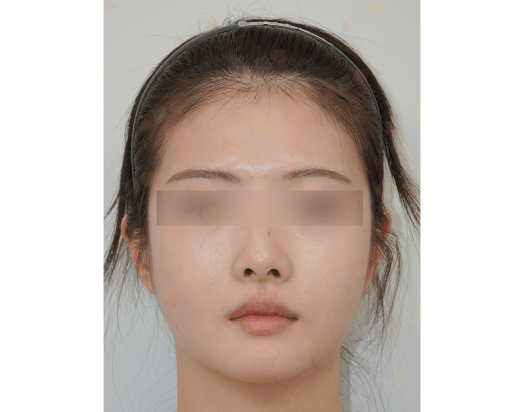 Person with headband and neutral expression.