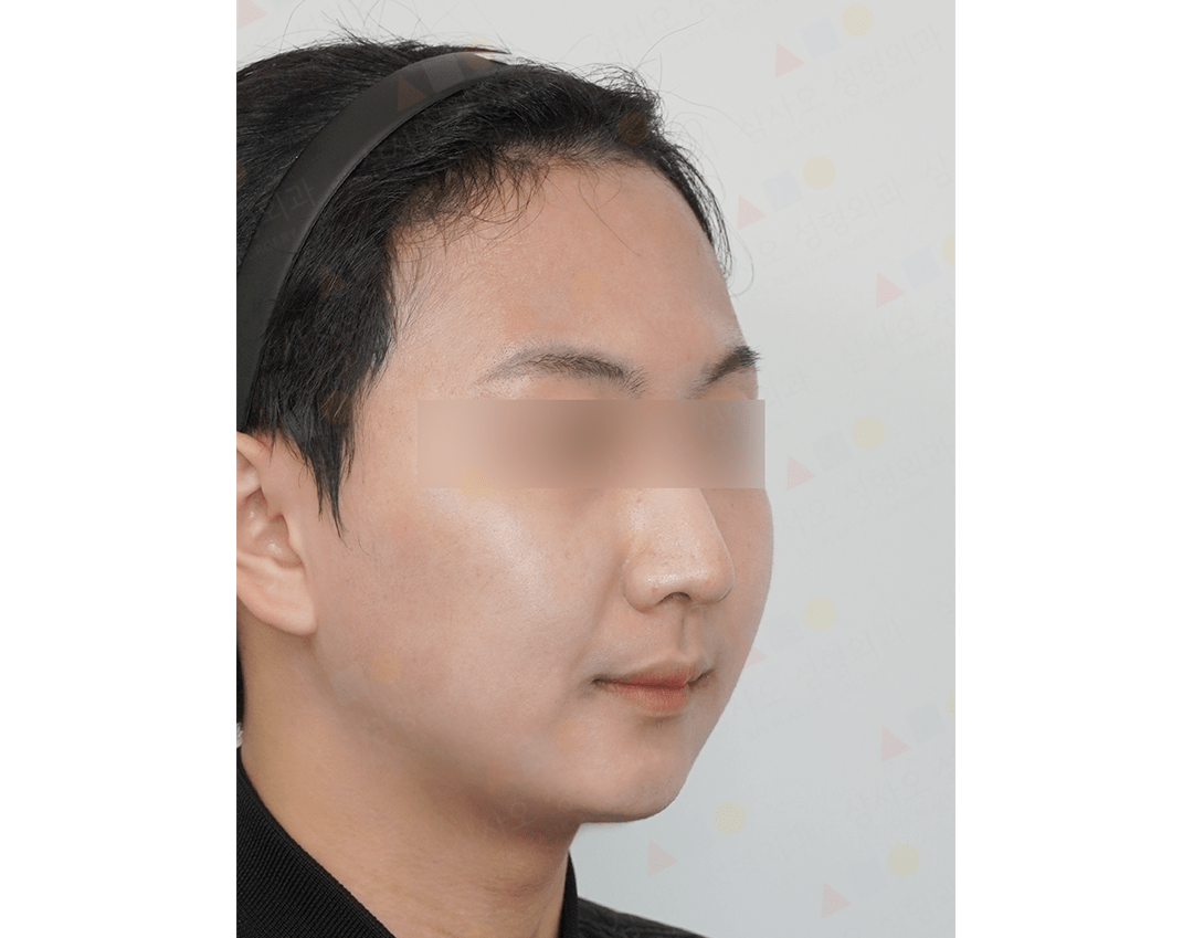 Side profile of a person with headband.
