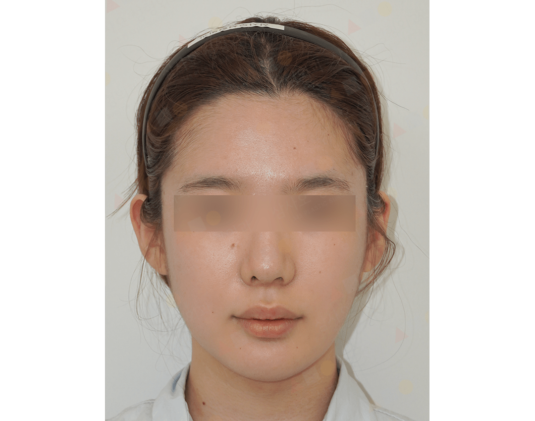 Woman wearing a headband.