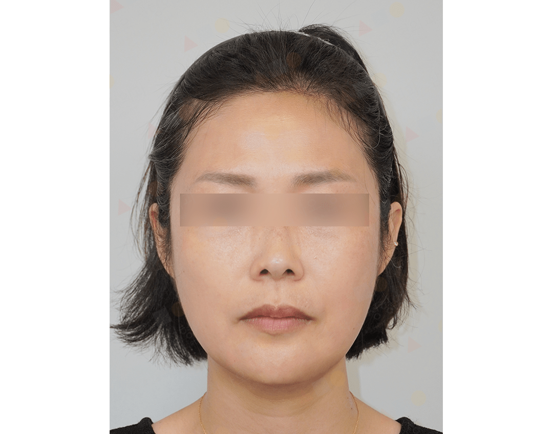 Portrait of a woman with blurred eyes