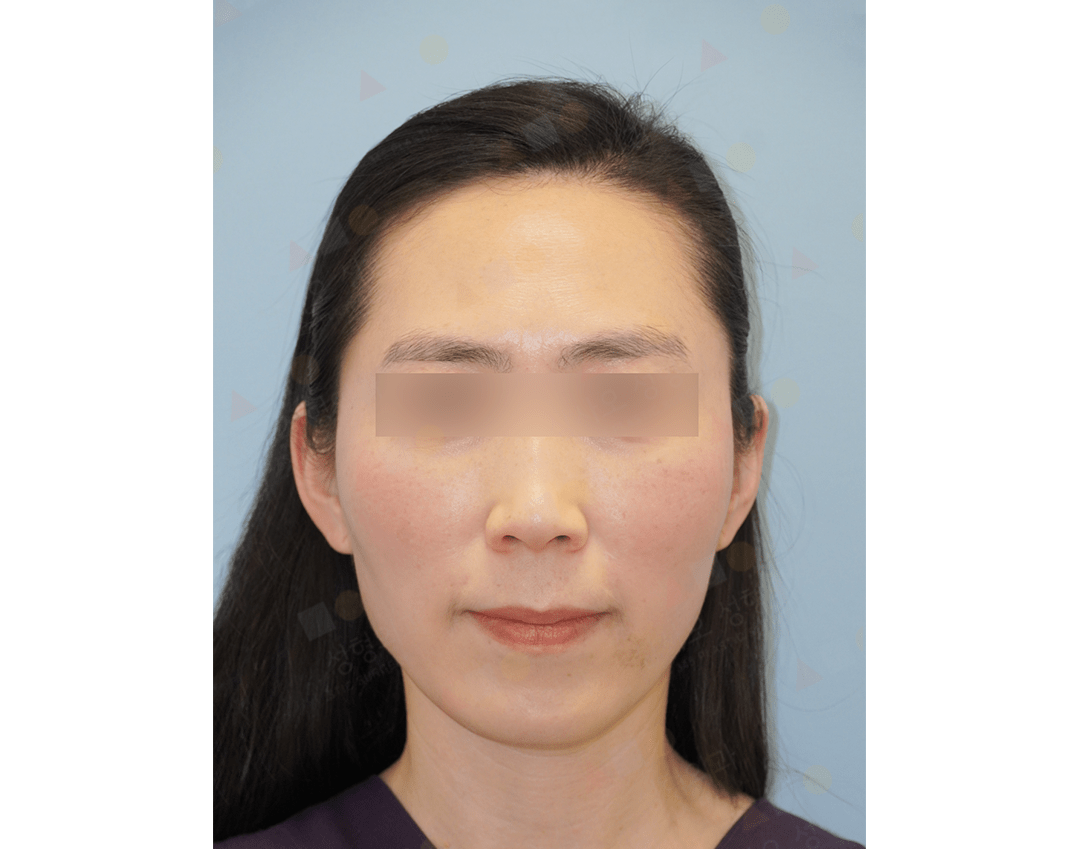 Woman with obscured eye area, neutral expression.