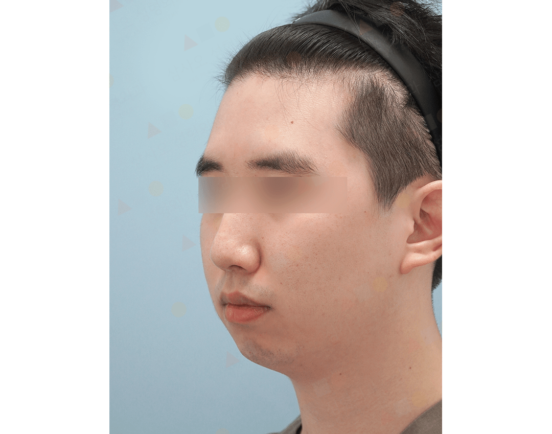 Man with hairband, side profile view.