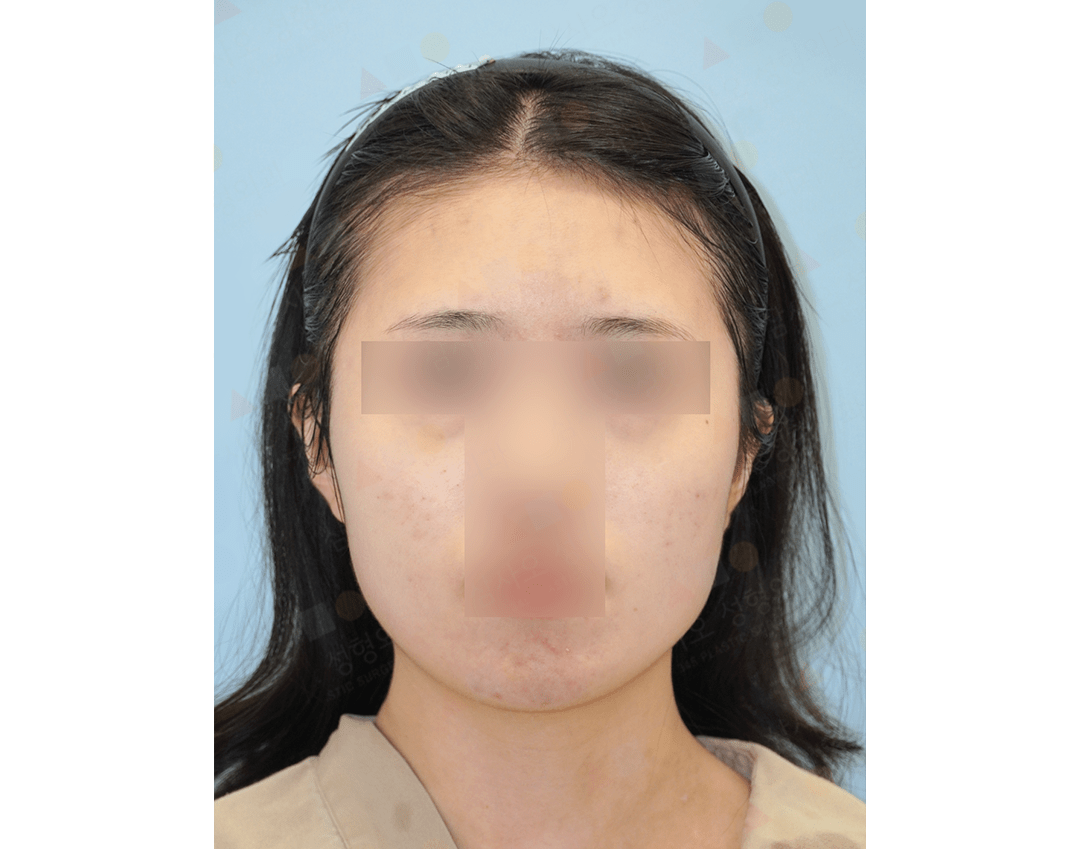 Unidentified person with facial blur for privacy.