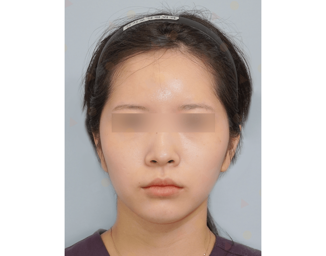 Woman with blurred eyes, wearing headband.