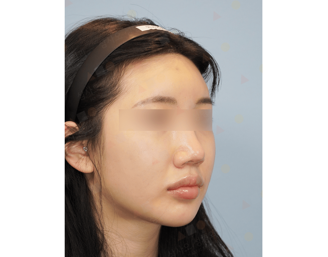 Woman in profile with hairband and blurred eyes.