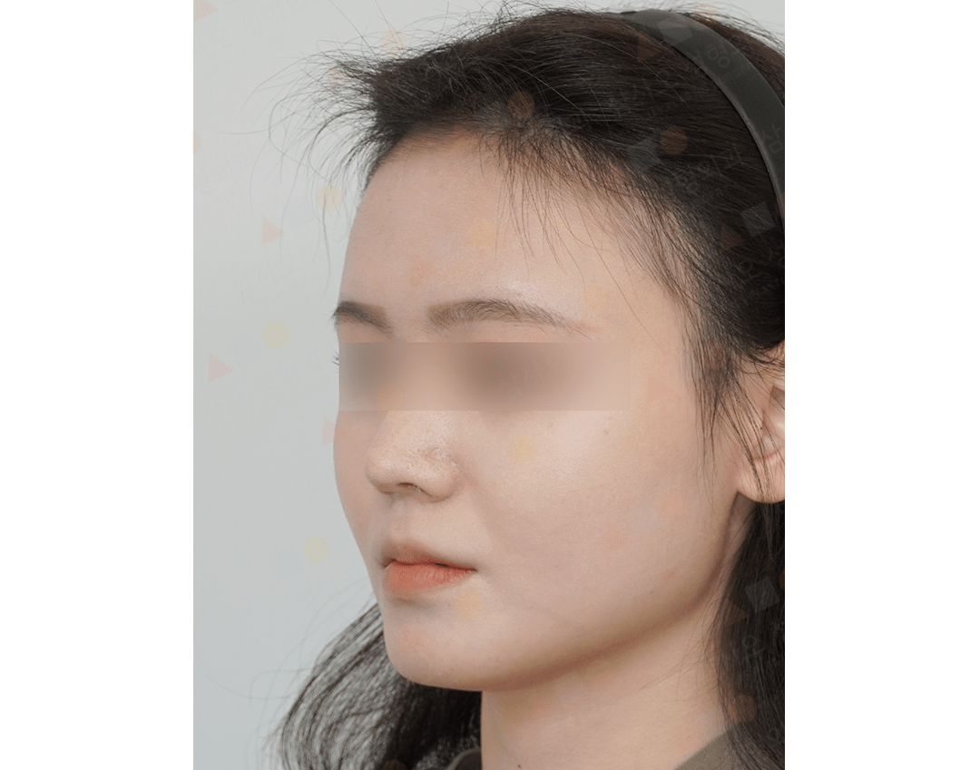 Side profile of a person with blurred eyes.