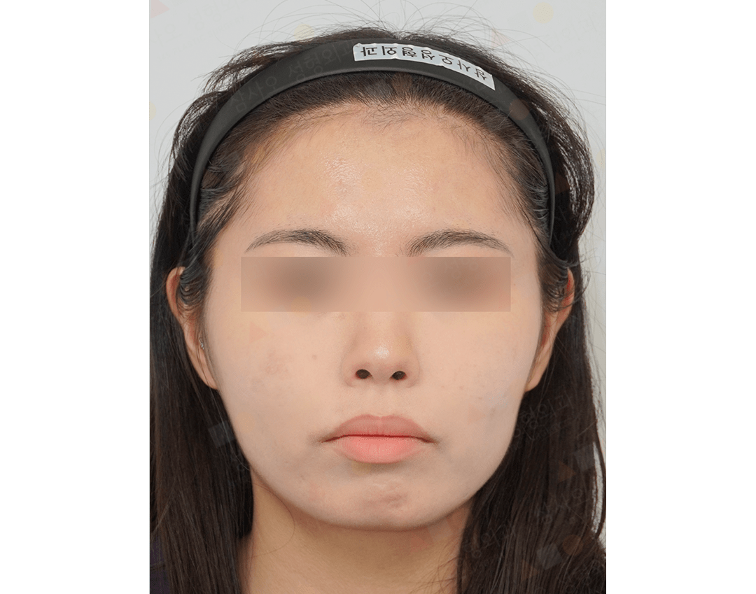 Woman with headband, eyes blurred for privacy.