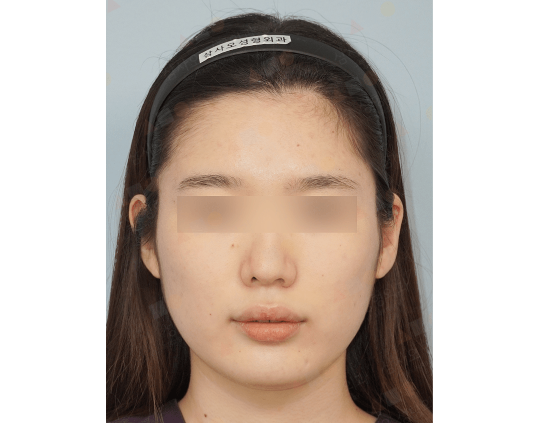 Person with headband, neutral expression