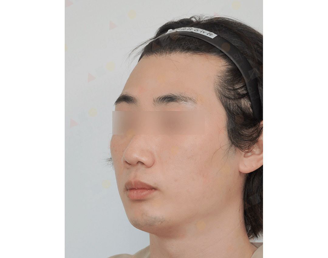 Person with headband, side view profile