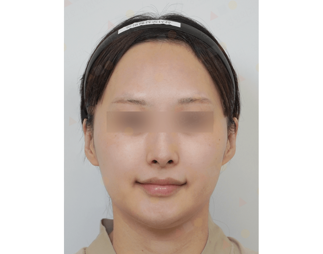 Person with blurred eyes wearing a headband