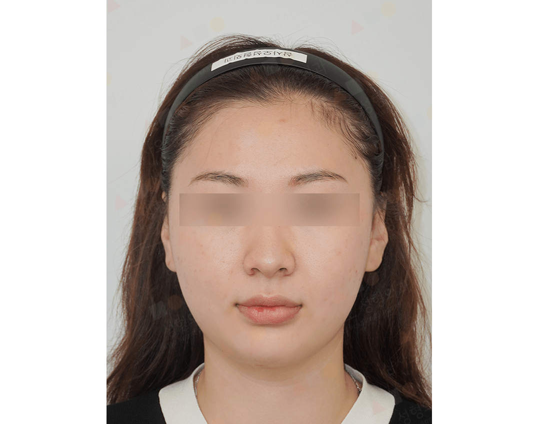 Woman with headband, neutral expression, front view.