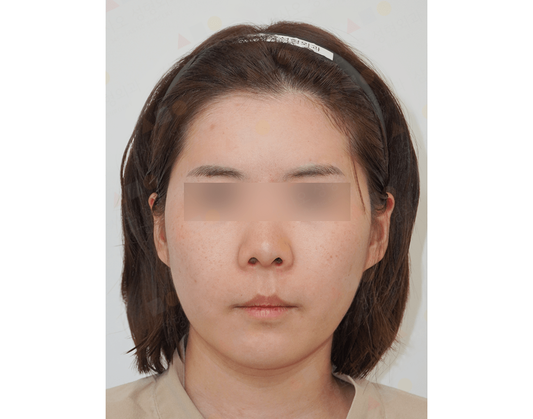 Facial portrait of woman with headband.