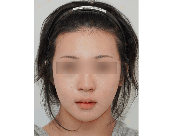 Person with headband, eyes blurred, neutral expression