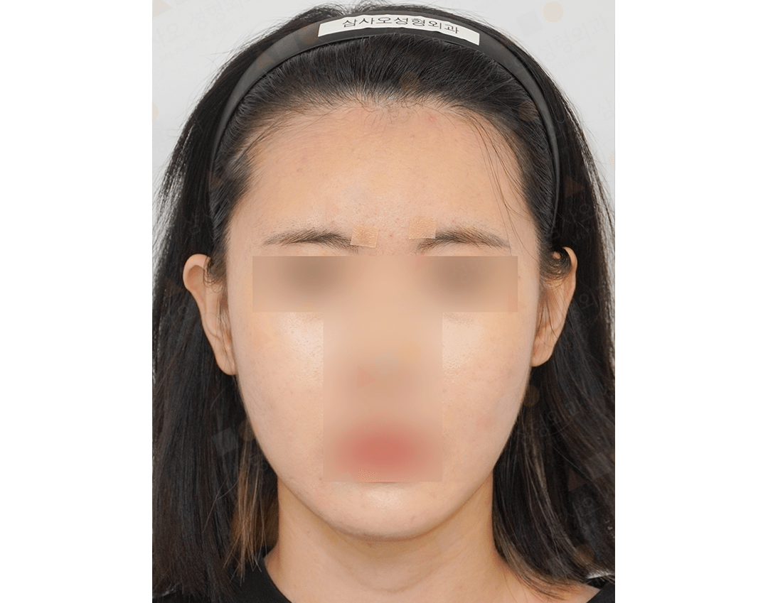 Person wearing black headband, face blurred for privacy.
