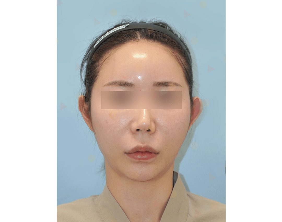 Person with blurred eyes and hairband.