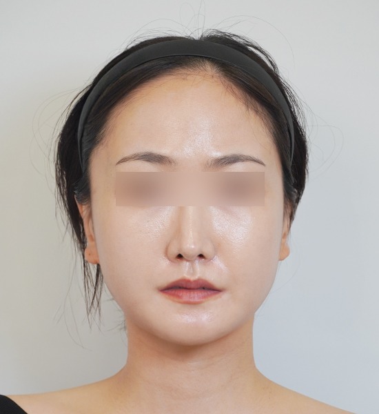 Person with blurred eyes and headband