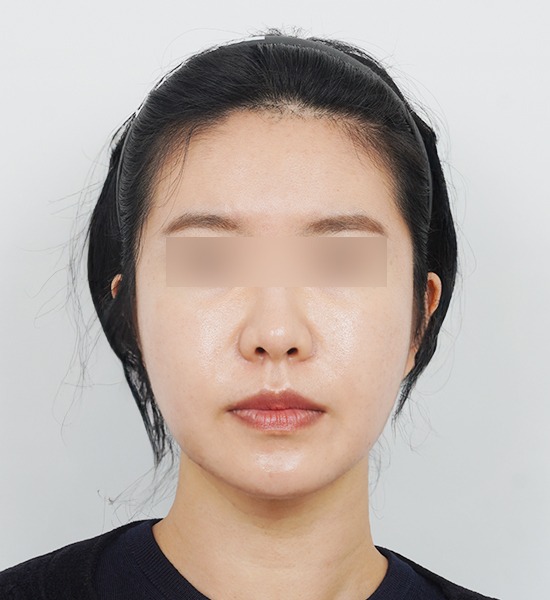 Woman with headband and neutral expression.