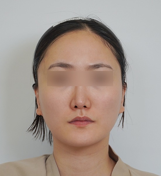 Person with blurred eyes facing forward background
