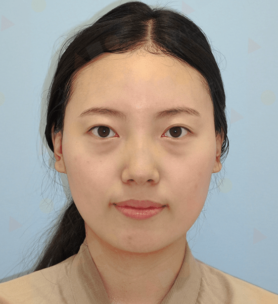 Person with dark hair against blue background