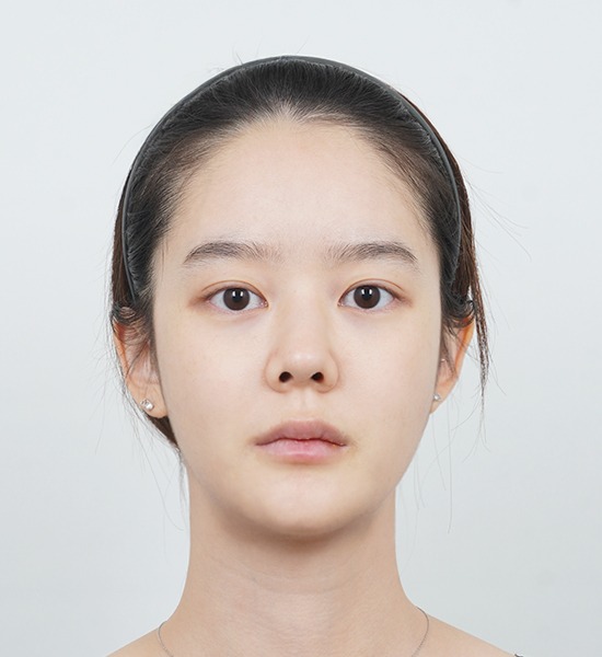 Person with neutral expression and headband.