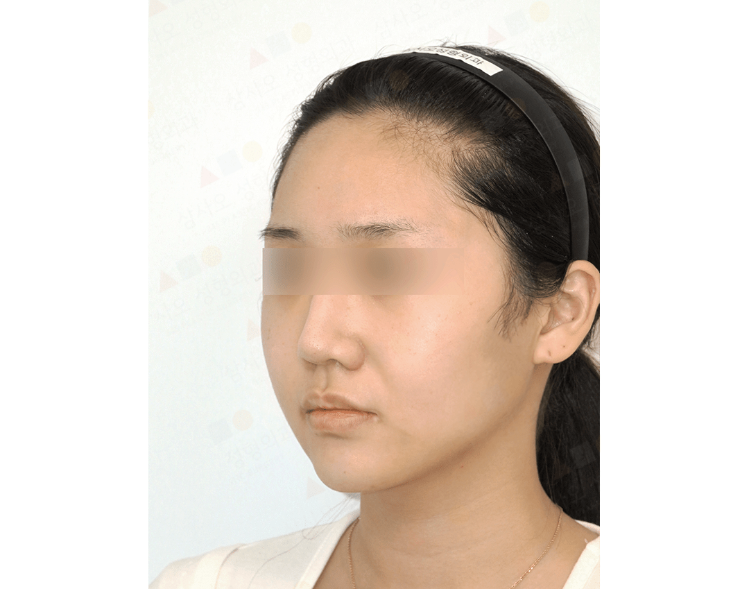 Woman with headband, side view, blurred eyes.