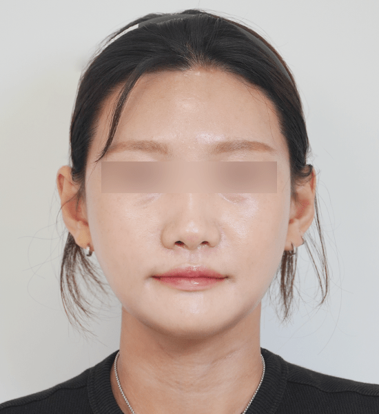 Person with blurred facial features, neutral expression.