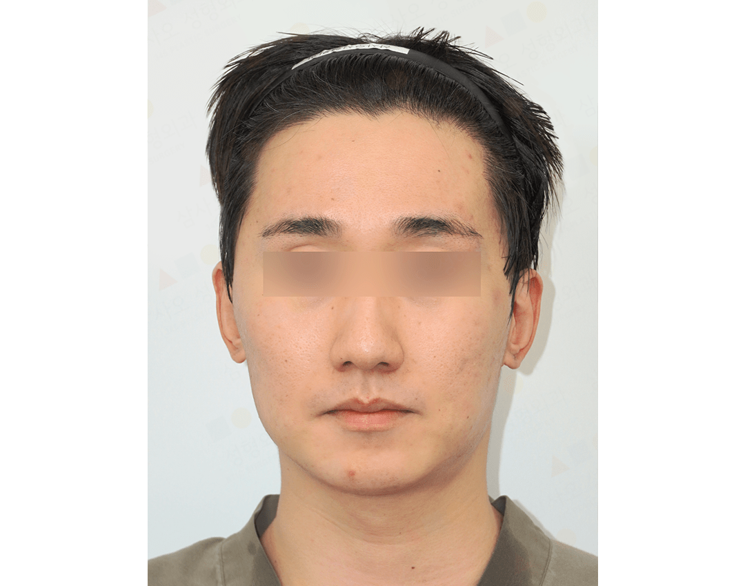 Person with short hair, blurred eyes, neutral expression.