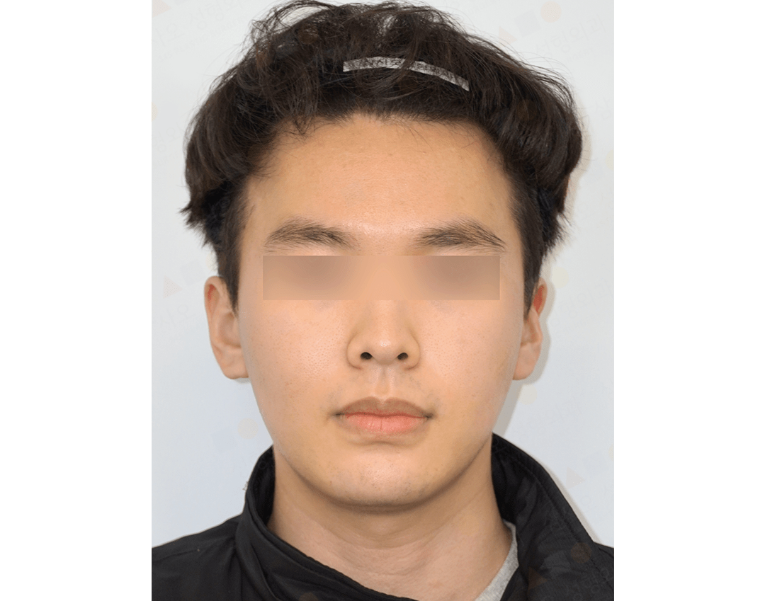 Man with blurred eyes and dark hair wearing jacket