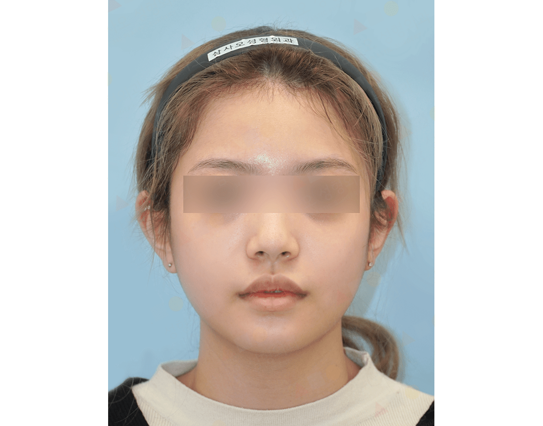 Person wearing headband, neutral expression, blurred eyes.