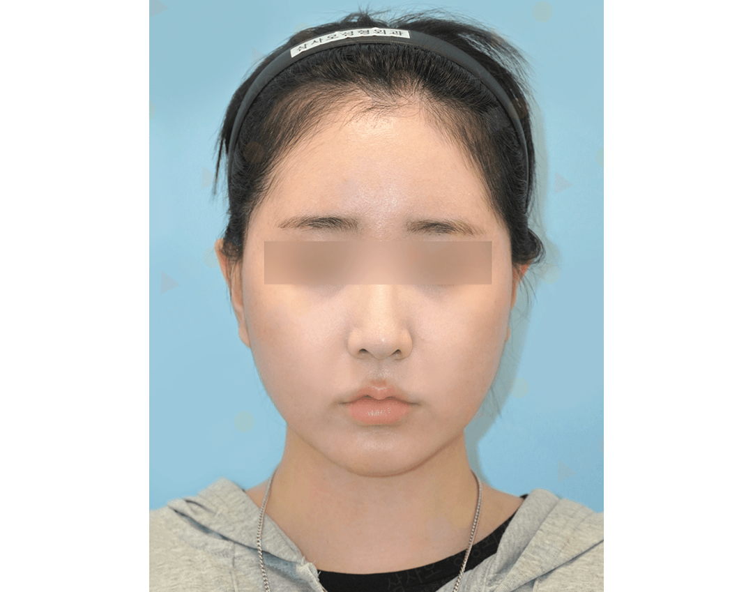Person wearing a headband, facing forward.