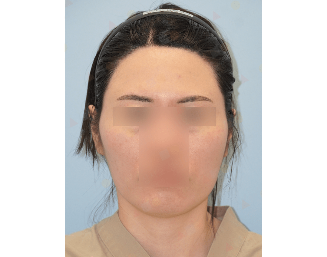 Person with obscured facial features in headshot