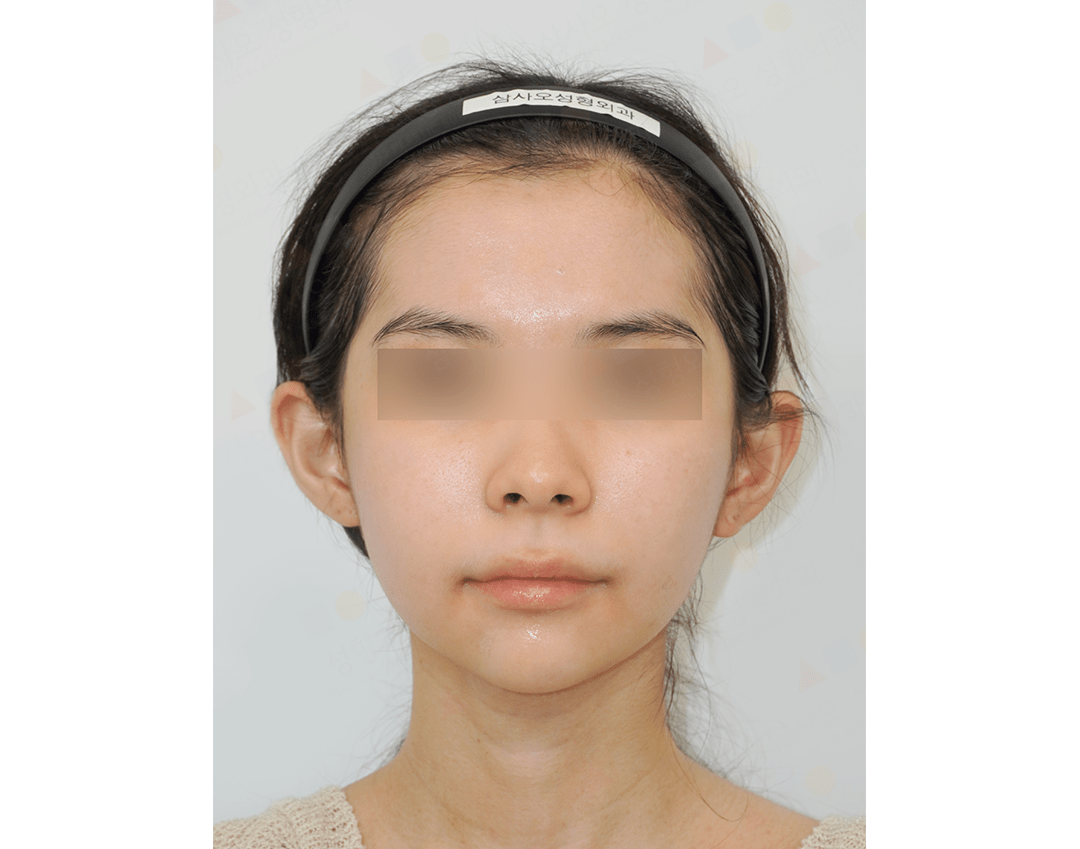 Person with blurred eyes wearing a headband