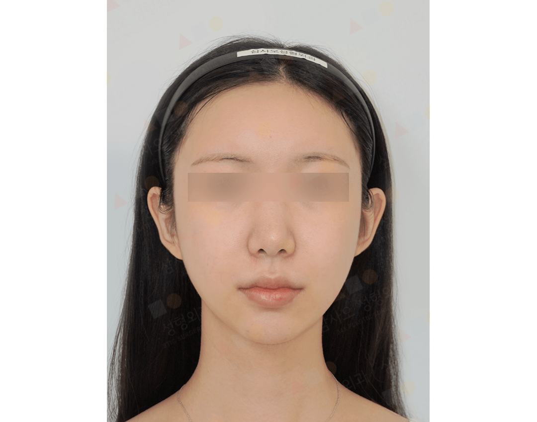Woman with headband, neutral expression.