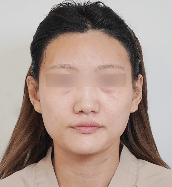 Person with blurred eyes and straight hair.