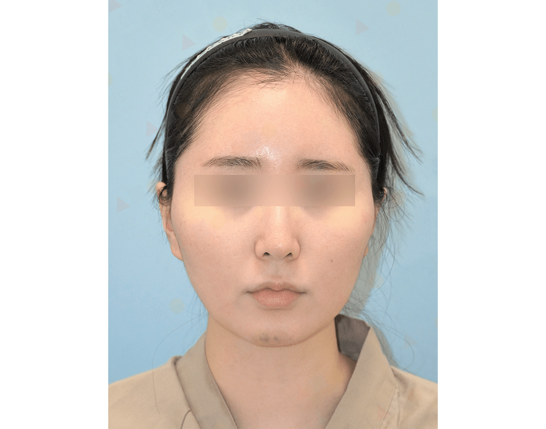 Person with headband facing camera, neutral expression.